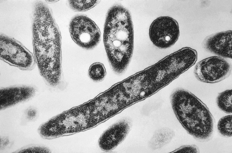 Why Can't We Eliminate Legionnaires' Disease?