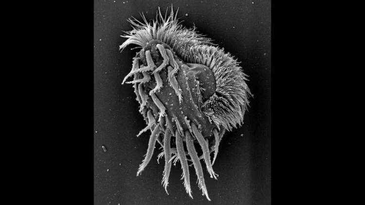 Microbe Turns Into a 'Hulk' That Eats Its Own Kind