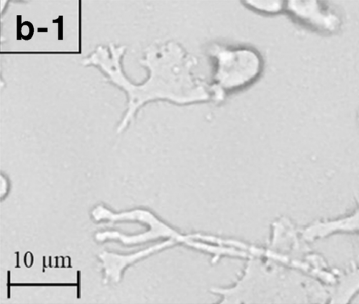 Lessons From Toddler's Tragic Brain-Eating Amoeba Death