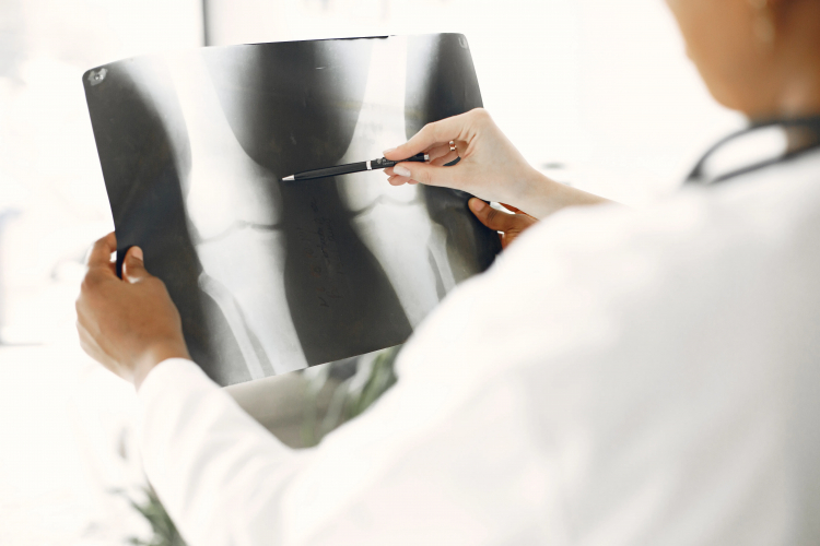 Hypertension May Be Quietly Wrecking Your Cartilage