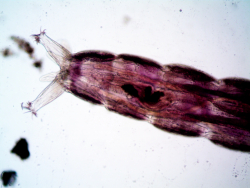 A Mother's Age Can Affect Offspring in Mysterious Ways
