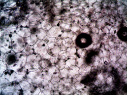 How Old Fat Cells Trigger Inflammation