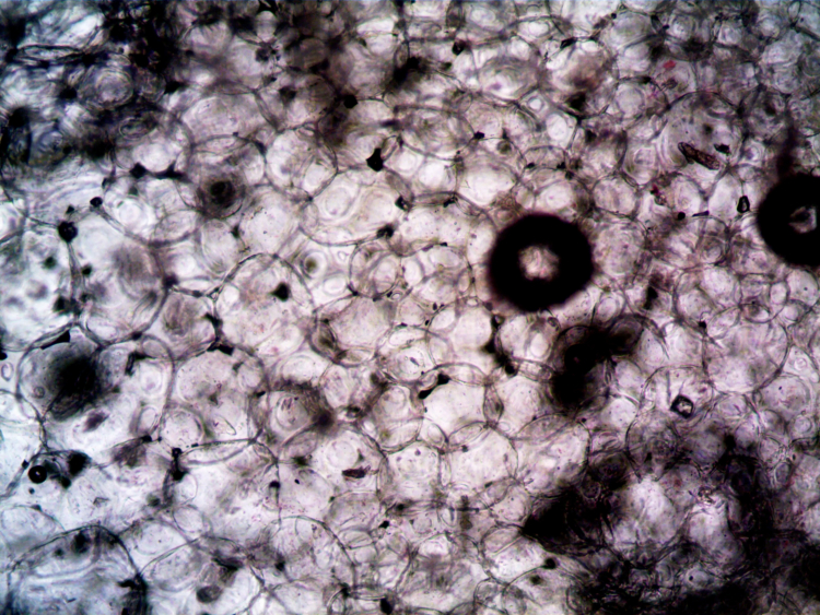 How Old Fat Cells Trigger Inflammation