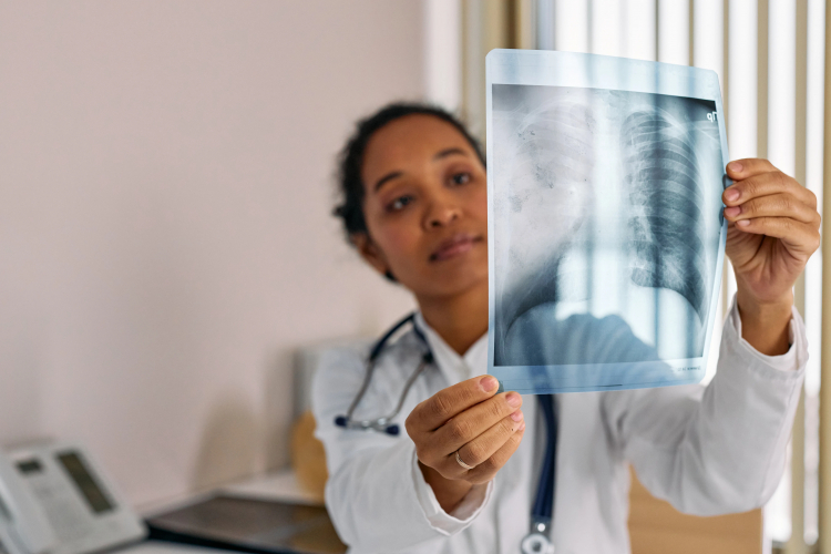 Scientists Uncover Cell Type That Shields Lung Cancer