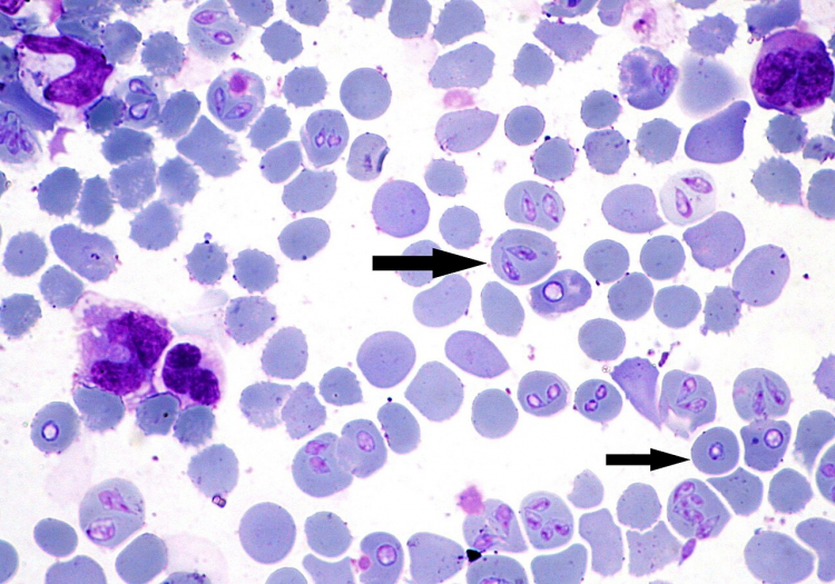 Unnerving Parasite Link in Deaths of Six Young People