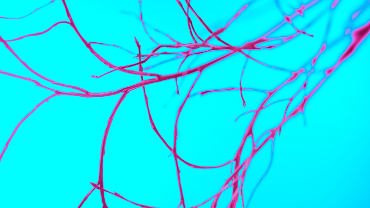 The Coronary Artery Inflammation Controversy
