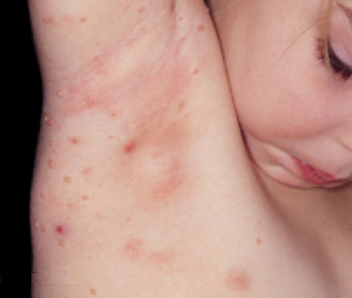 Scientists Found Virus a That's a Tiny Bit Human