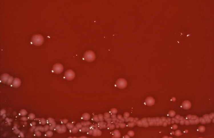A Diarrhea Pathogen Is Morphing Into an STI
