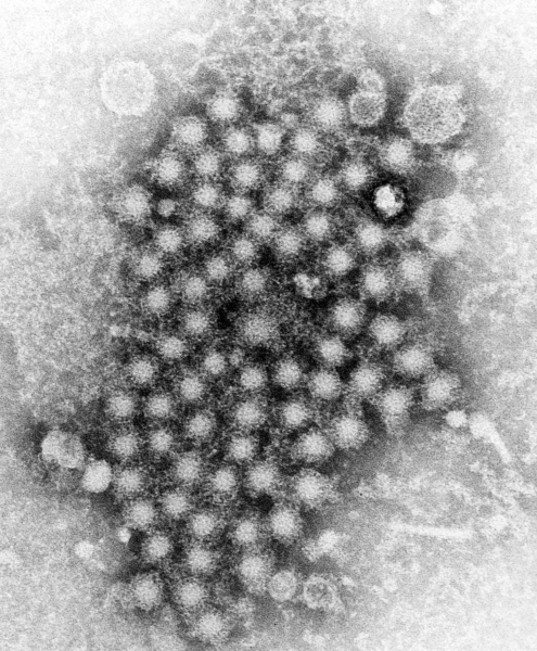CDC May Fund 'Unethical' Vaccine Trial