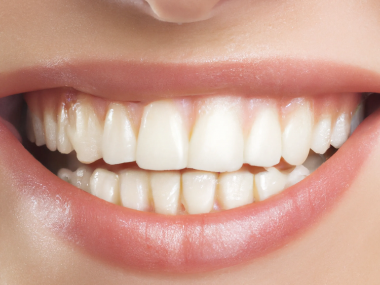 Does Teeth Whitening Gum Actually Work?